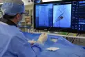 A hospital in Hamilton leads a new medical procedure to reduce the risk of strokes